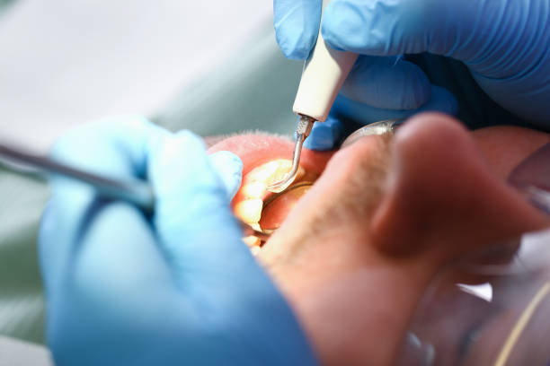 Best Emergency Gum Treatment in Lewiston, UT
