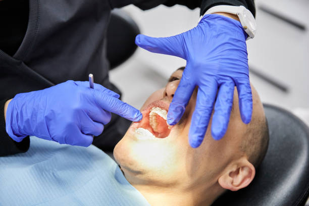 Best Emergency Treatment for Dental Infections or Abscesses in Lewiston, UT