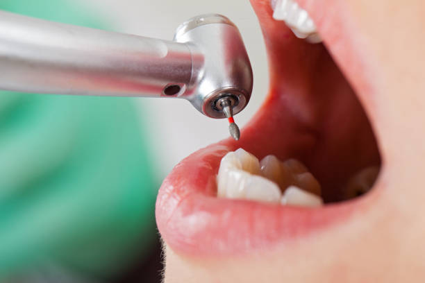 Best Cosmetic Emergency Dentistry in Lewiston, UT